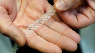 Johnson & Johnson Fined $344 Million for Selling Transvaginal Mesh Implants Despite Health Warnings